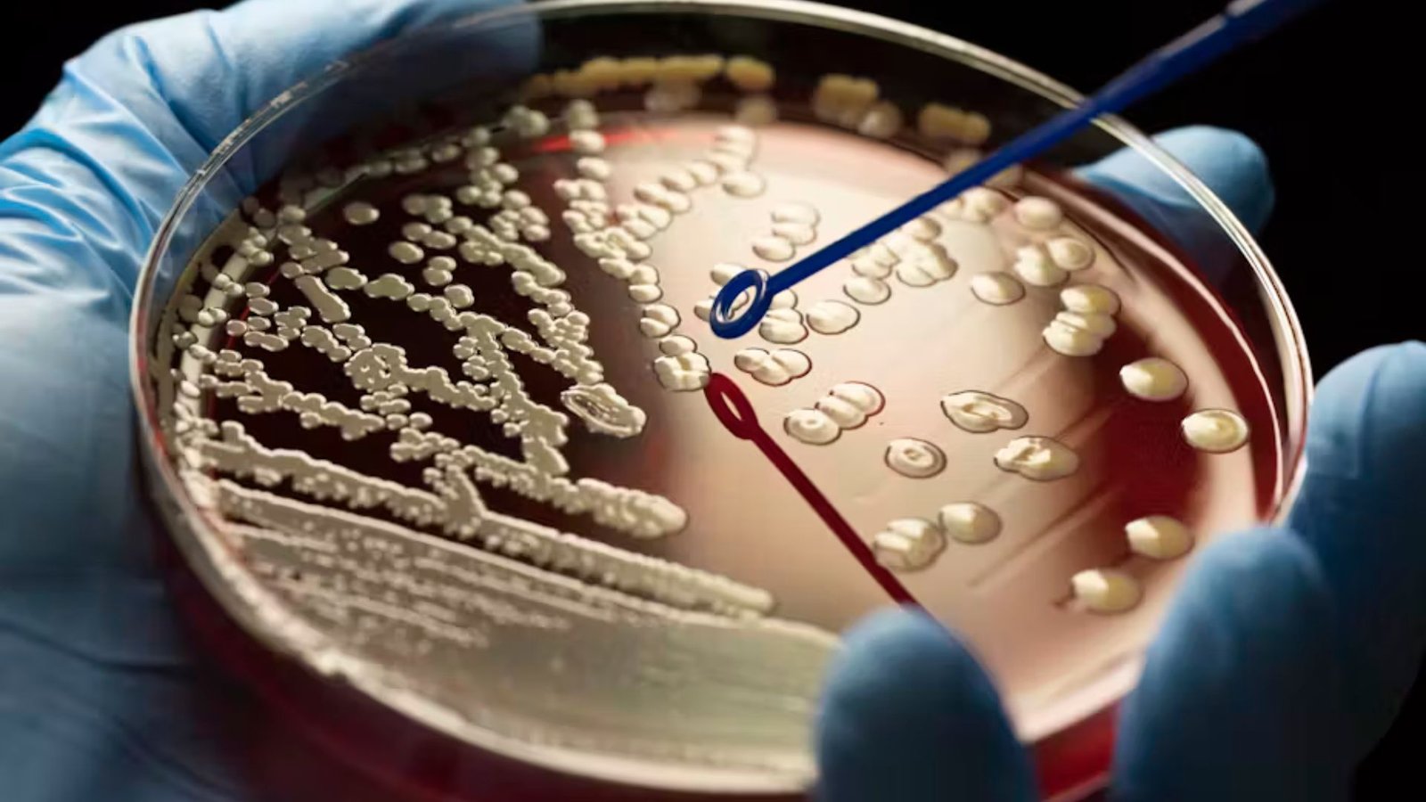 How Pharma Companies Are Addressing Antibiotic Resistance